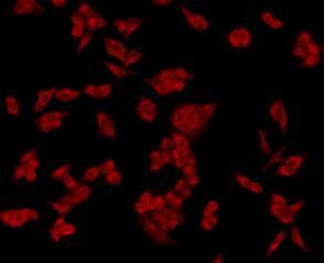 GRP78 BiP Antibody in Immunocytochemistry (ICC/IF)