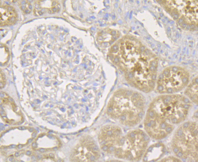 Transferrin Antibody in Immunohistochemistry (Paraffin) (IHC (P))