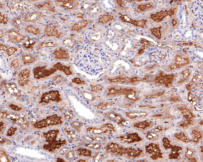 Transferrin Antibody in Immunohistochemistry (Paraffin) (IHC (P))