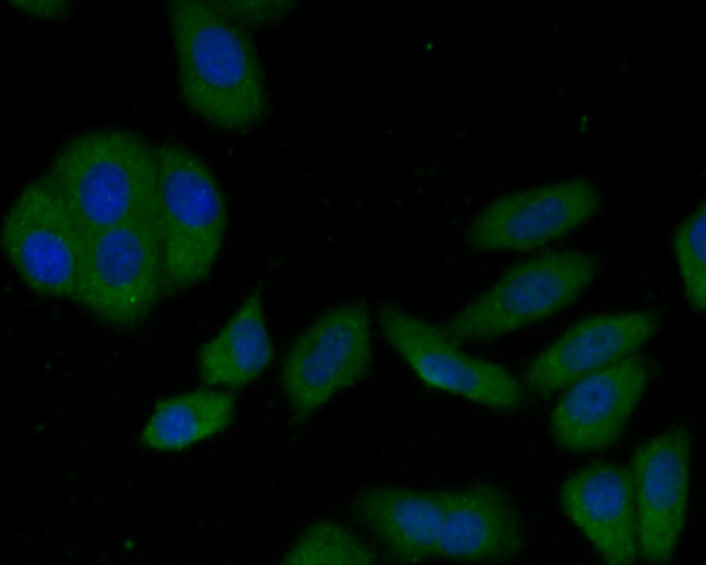LAMP2 Antibody in Immunocytochemistry (ICC/IF)