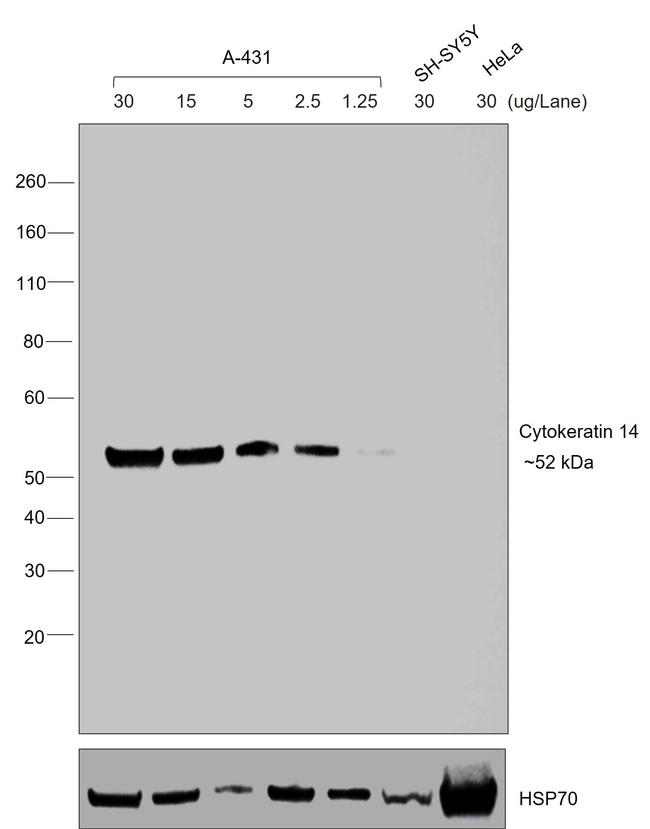 Mouse IgG3 Cross-Adsorbed Secondary Antibody in Western Blot (WB)