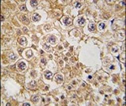 M6PR Antibody in Immunohistochemistry (IHC)