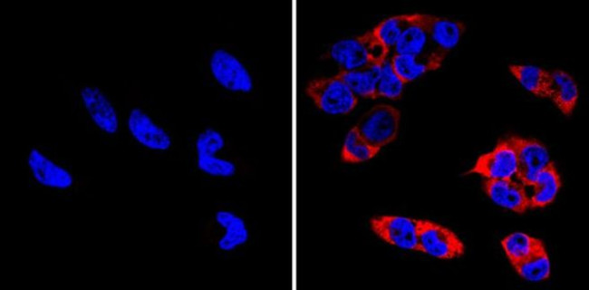 LIN28A Antibody in Immunocytochemistry (ICC/IF)