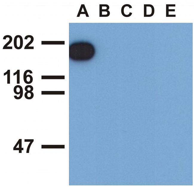 Phospho-EGFR (Tyr1173) Antibody in Western Blot (WB)