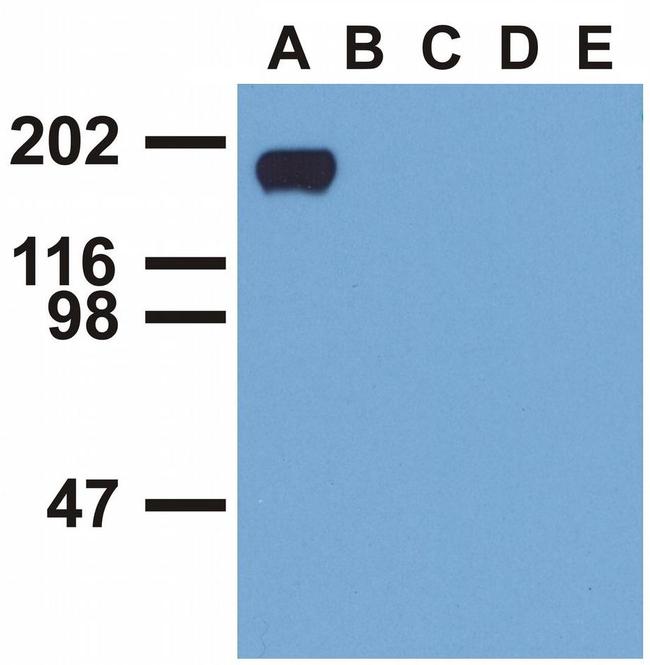 Phospho-EGFR (Tyr992) Antibody in Western Blot (WB)