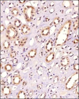 POLE3 Antibody in Immunohistochemistry (Paraffin) (IHC (P))