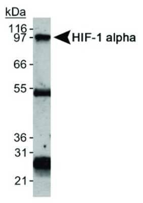 HIF1A Antibody in Immunoprecipitation (IP)