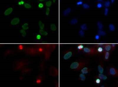 RAD51D Antibody in Immunocytochemistry (ICC/IF)
