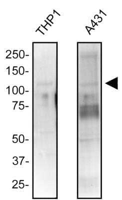 NOD2 Antibody in Western Blot (WB)