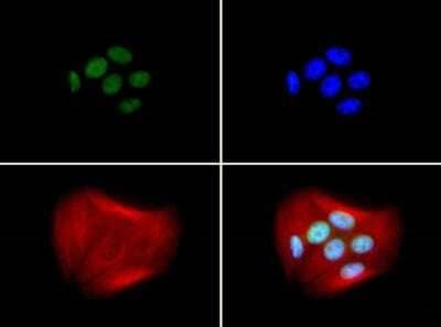 BRCA1 Antibody in Immunocytochemistry (ICC/IF)