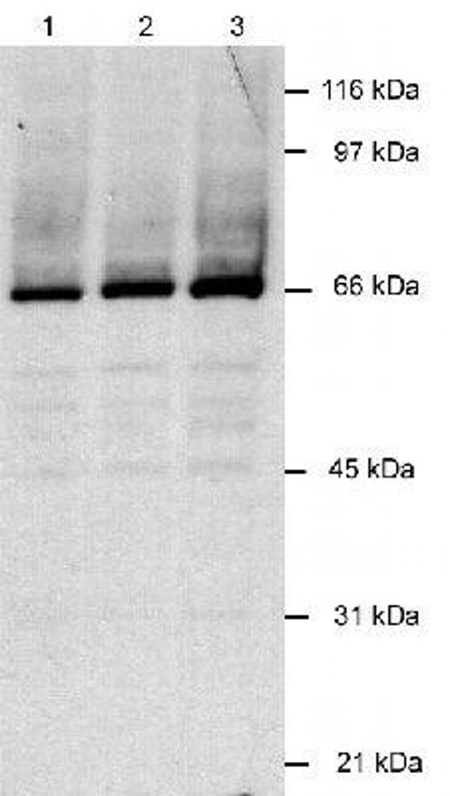 KSHV LANA2 Antibody in Western Blot (WB)