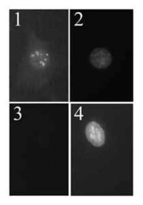 p19ARF Antibody in Immunocytochemistry (ICC/IF)