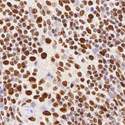 hnRNP M3-M4 Antibody in Immunohistochemistry (Paraffin) (IHC (P))