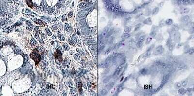 Bestrophin 1 Antibody in Immunohistochemistry (Paraffin) (IHC (P))