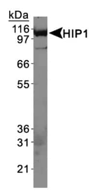 HIP1 Antibody in Western Blot (WB)