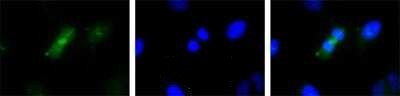 Survivin Antibody in Immunocytochemistry (ICC/IF)