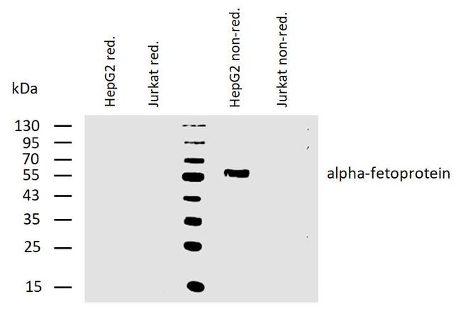 Afp Wb AFP Monoclonal Antibody (AFP-11) | Invitrogen (MA1-19342)