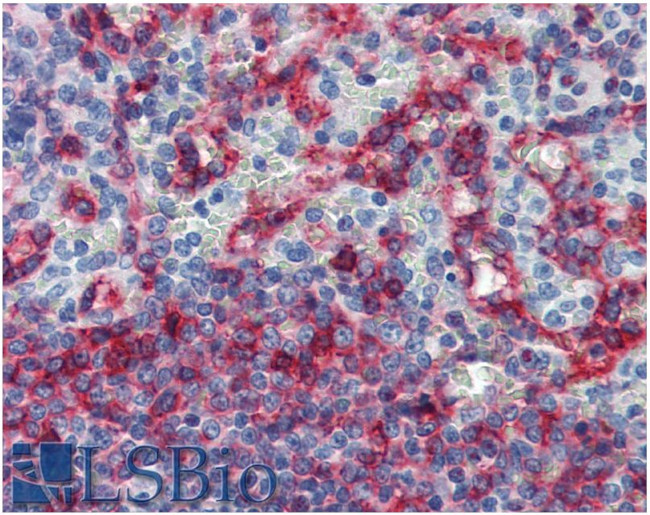 HLA-E Antibody in Immunohistochemistry (Paraffin) (IHC (P))