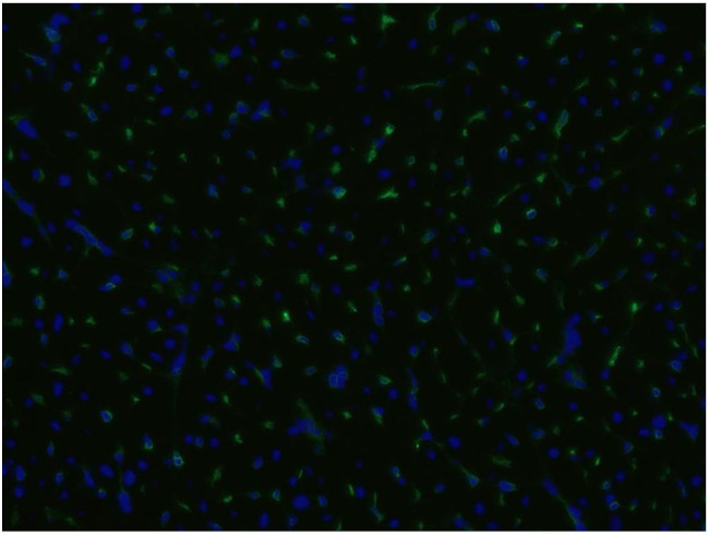 CD105 Antibody in Immunocytochemistry (ICC/IF)