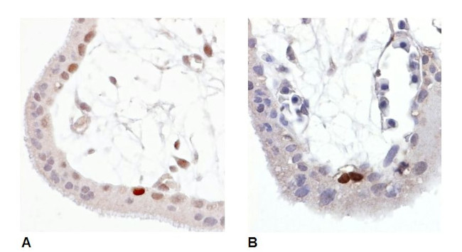 Phospho-p53 (Ser392) Antibody in Immunohistochemistry (Paraffin) (IHC (P))