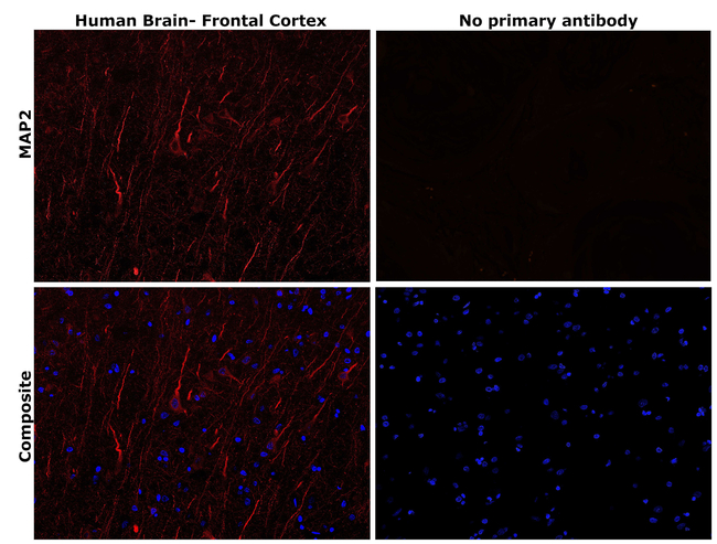 MAP2 Antibody in Immunohistochemistry (Paraffin) (IHC (P))