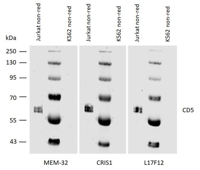 CD5 Antibody in Western Blot (WB)