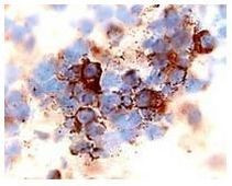 CXCR4 / CD184 Antibody in Immunohistochemistry (Paraffin) (IHC (P))