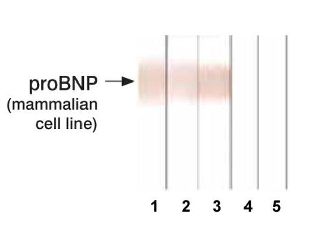 pro-Brain Natriuretic Peptide Antibody in Western Blot (WB)