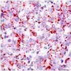 Myb Antibody in Immunohistochemistry (IHC)