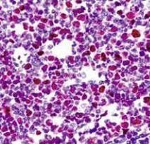 Cdc7 Antibody in Immunohistochemistry (IHC)