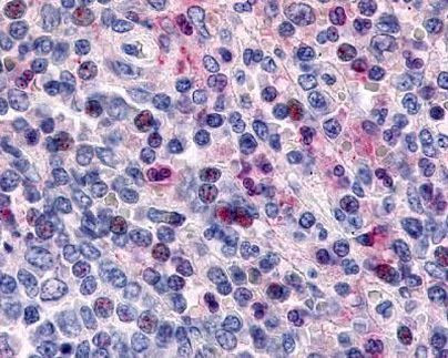 Avidin Antibody in Immunohistochemistry (IHC)