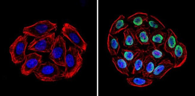 Ku70/Ku80 Antibody in Immunocytochemistry (ICC/IF)