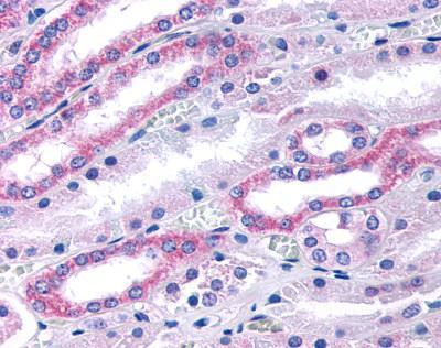 GUCY1B2 Antibody in Immunohistochemistry (IHC)