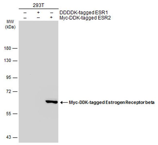 Estrogen Receptor beta Antibody in Western Blot (WB)