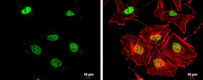 RAD50 Antibody in Immunocytochemistry (ICC/IF)