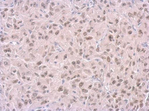 RPA14 Antibody in Immunohistochemistry (Paraffin) (IHC (P))