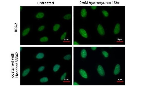 RPA2 Antibody in Immunocytochemistry (ICC/IF)