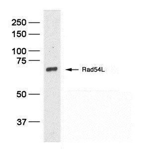RAD54L Antibody in Western Blot (WB)