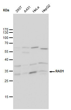 RAD1 Antibody in Western Blot (WB)