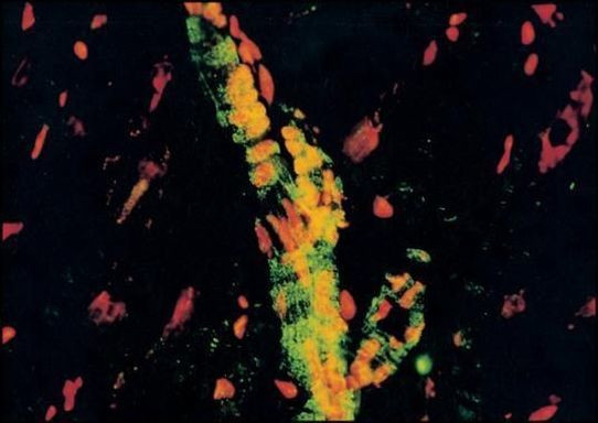 alpha Actinin 1 Antibody in Immunocytochemistry (ICC/IF)