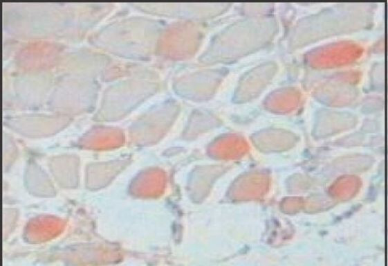 Slow Skeletal Muscle Myosin Antibody in Immunohistochemistry (Paraffin) (IHC (P))