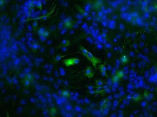 S100B Antibody in Immunocytochemistry (ICC/IF)