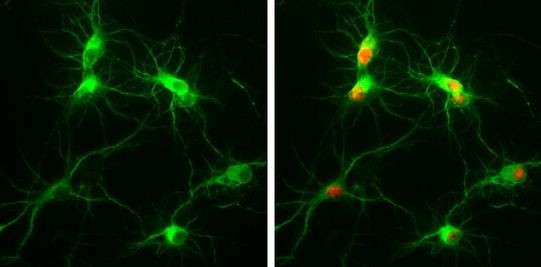 MAP2 Monoclonal Antibody (HM-2) (MA1-25043)