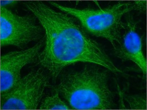 beta Tubulin Antibody in Immunocytochemistry (ICC/IF)