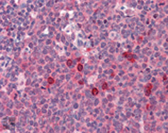 EXOC3 Antibody in Immunohistochemistry (IHC)