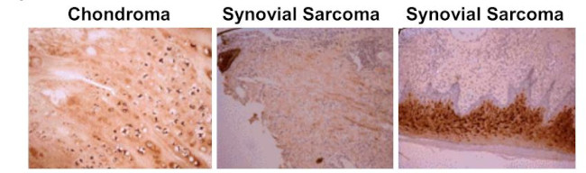 Osteocalcin Antibody in Immunohistochemistry (Paraffin) (IHC (P))