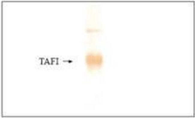 Carboxypeptidase B2 Antibody in Western Blot (WB)
