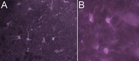 HLA-DR/DP/DQ Antibody in Immunohistochemistry (IHC)