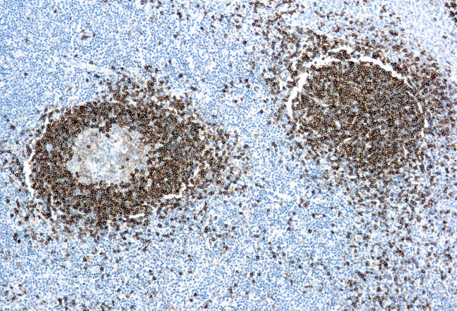Hairy Cell Leukemia Antibody in Immunohistochemistry (Paraffin) (IHC (P))