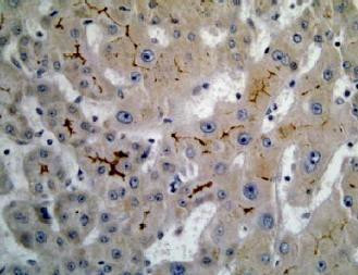 MRP6 Antibody in Immunohistochemistry (IHC)